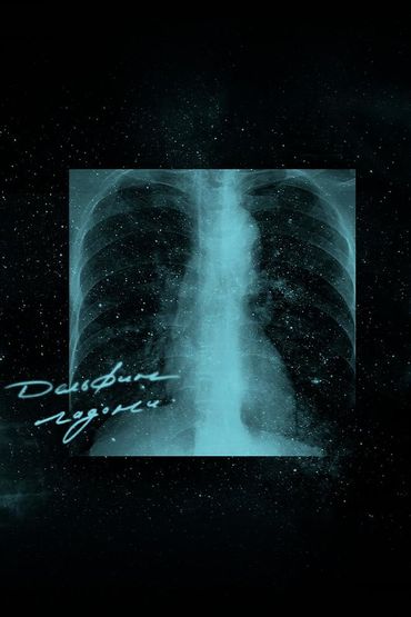 Дельфин - Ладони