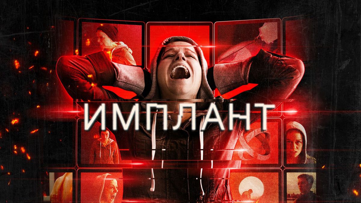 Имплант