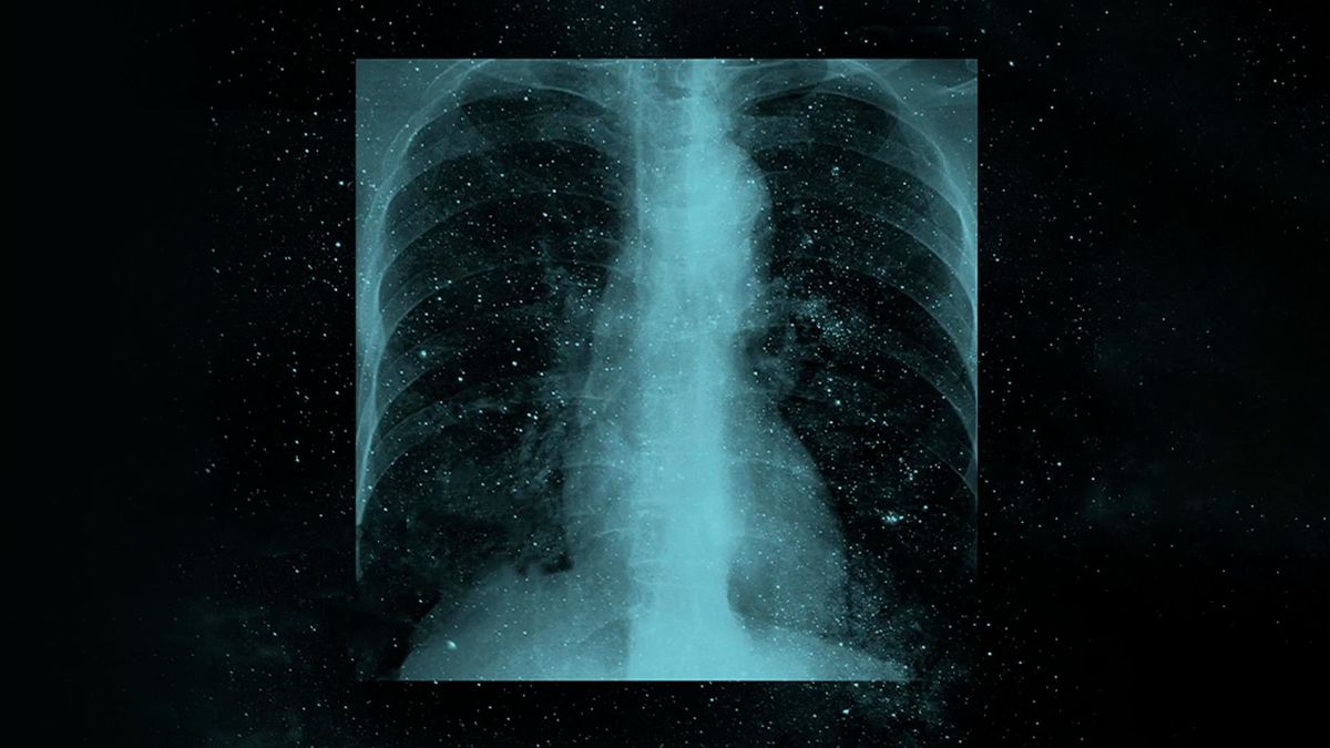 Дельфин - Ладони